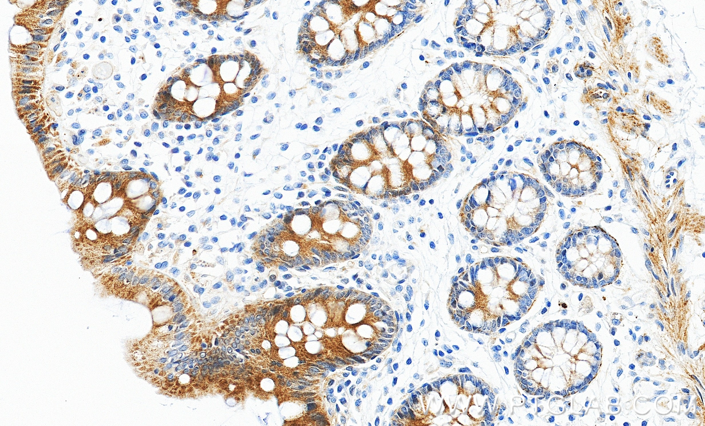 IHC staining of human colon using 98690-1-RR