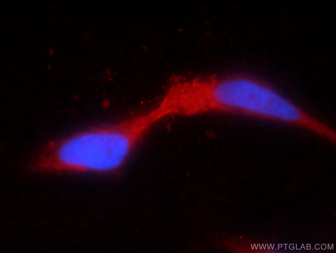 IF Staining of HEK-293 using 17322-1-AP