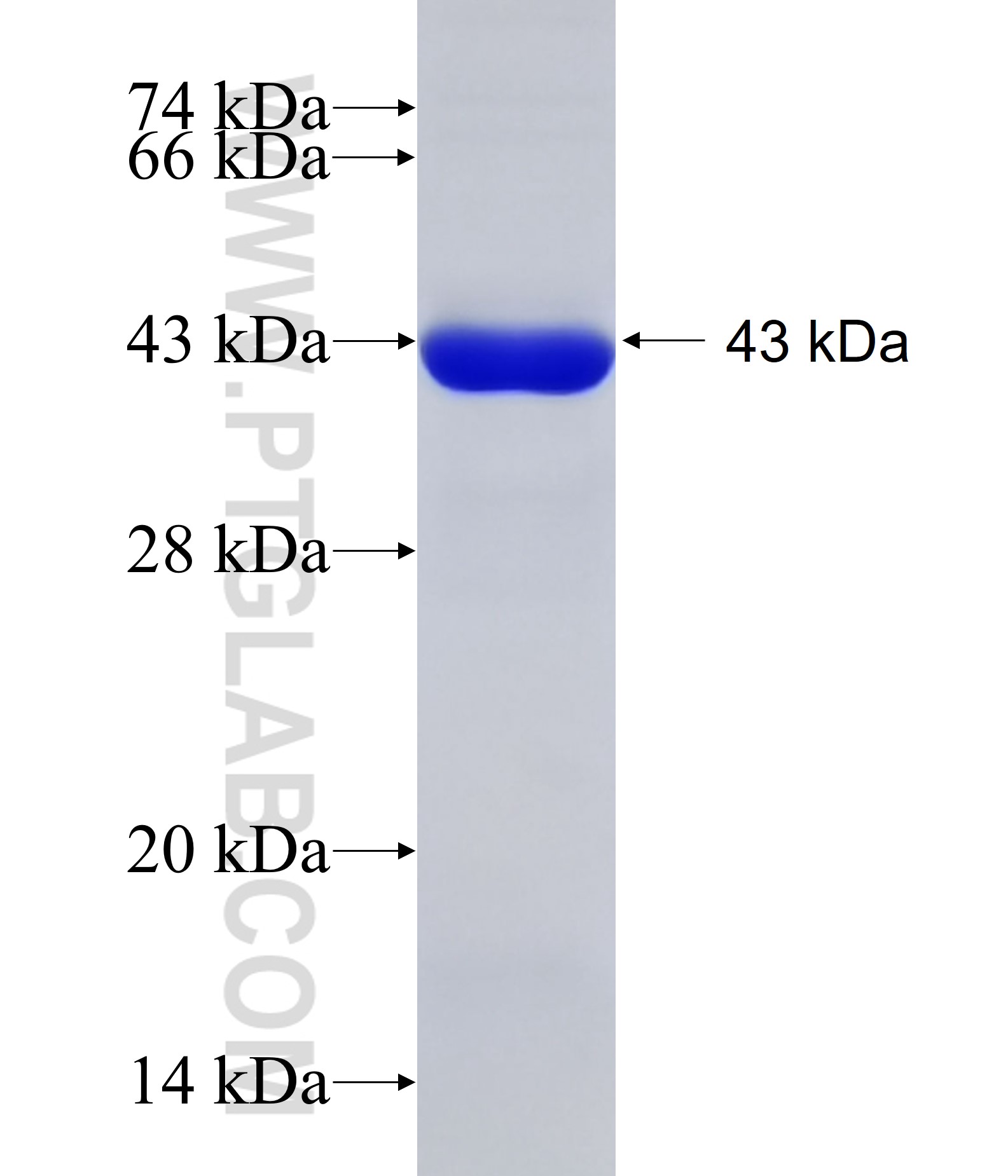 TRPV5 fusion protein Ag11326 SDS-PAGE