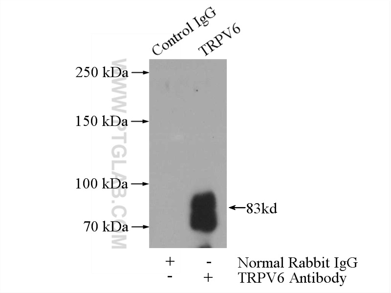 IP experiment of mouse kidney using 13411-1-AP