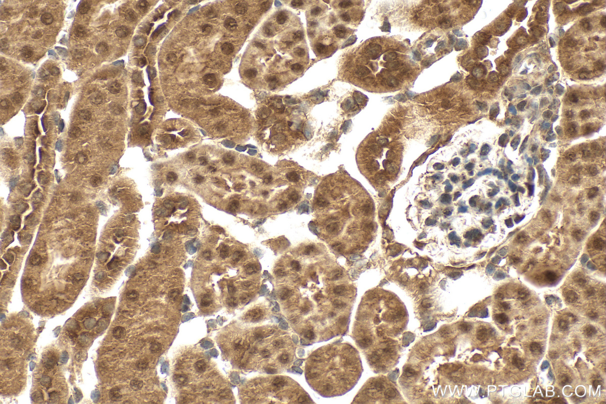 IHC staining of mouse kidney using 12520-1-AP