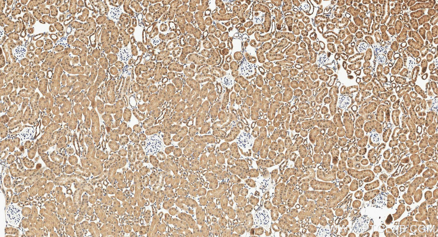 IHC staining of mouse kidney using 12520-1-AP IHC staining of mouse kidney using 12520-1-AP
