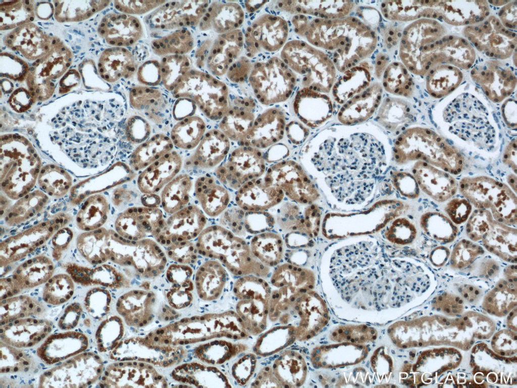 IHC staining of human kidney using 12520-1-AP
