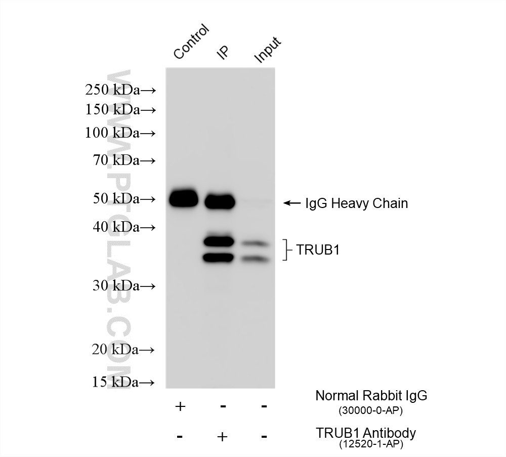 IP experiment of HepG2 using 12520-1-AP