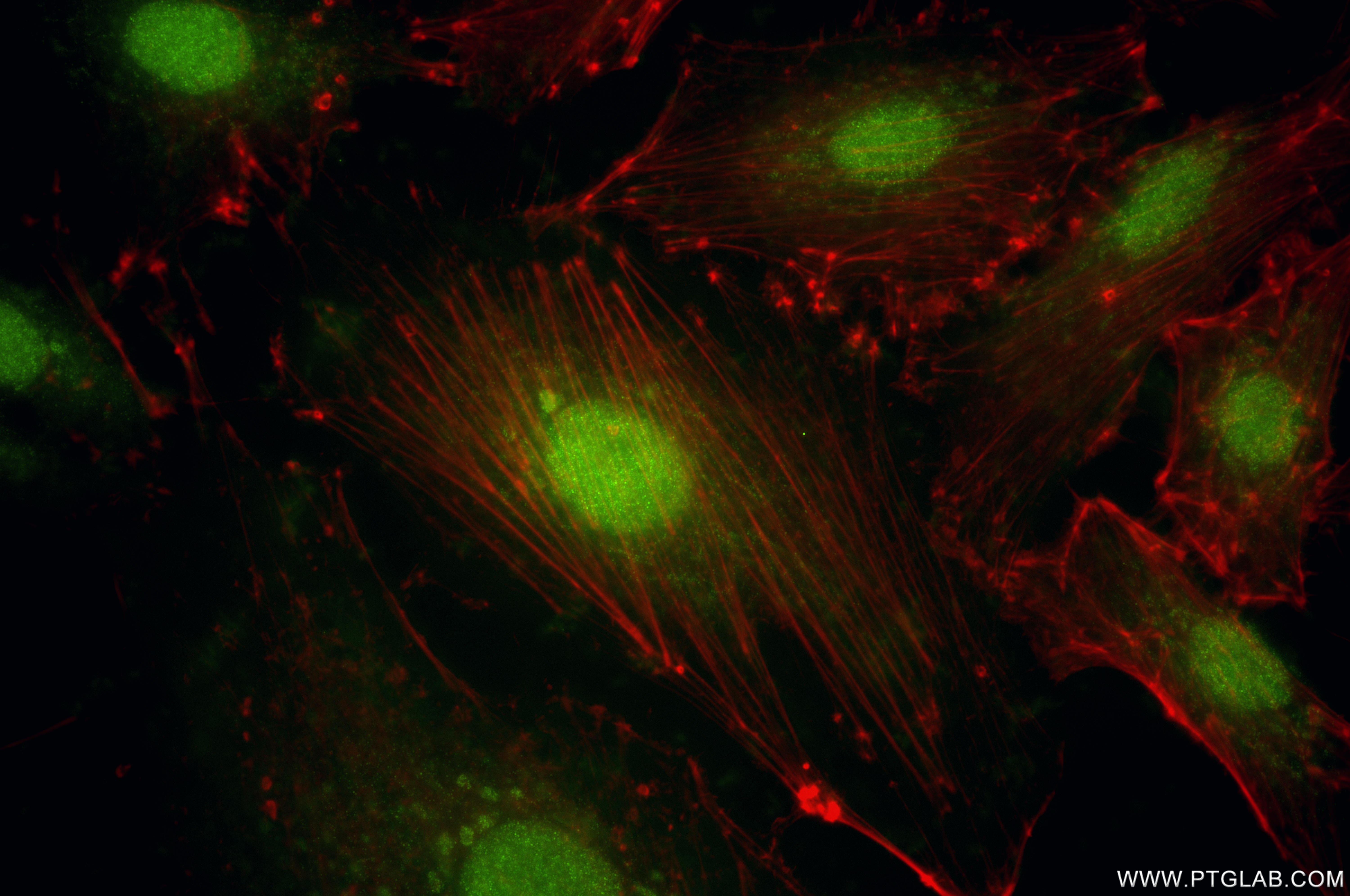 IF Staining of A549 using 85746-1-RR