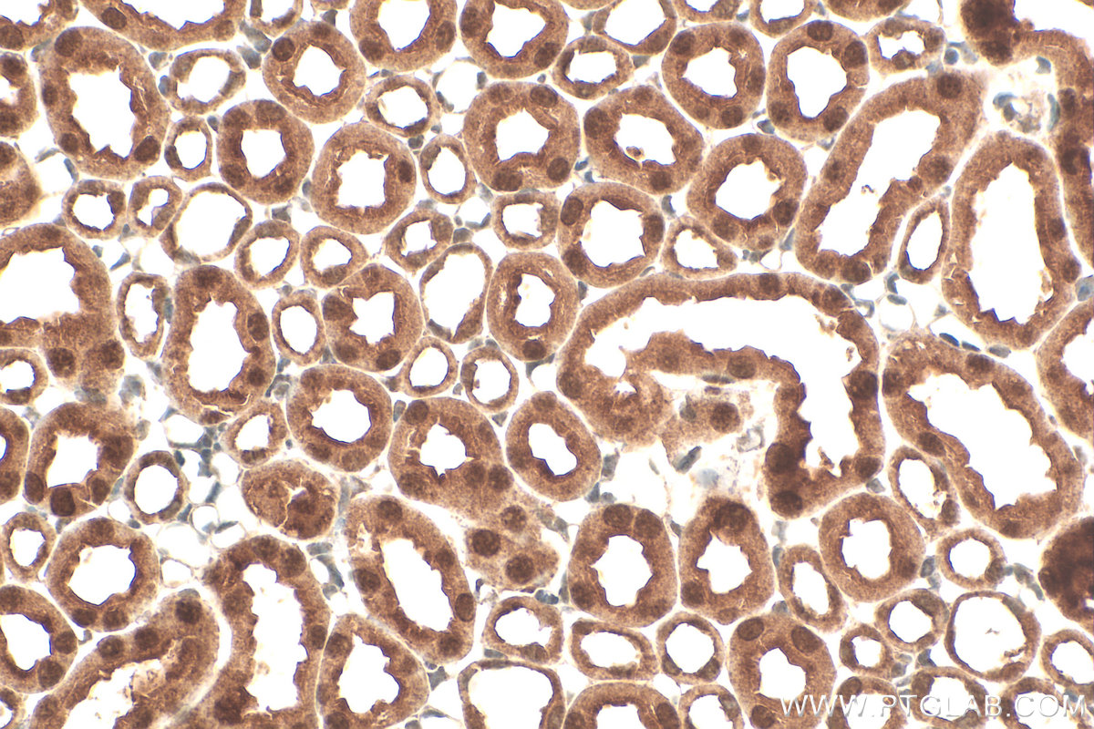 IHC staining of mouse kidney using RMX00073