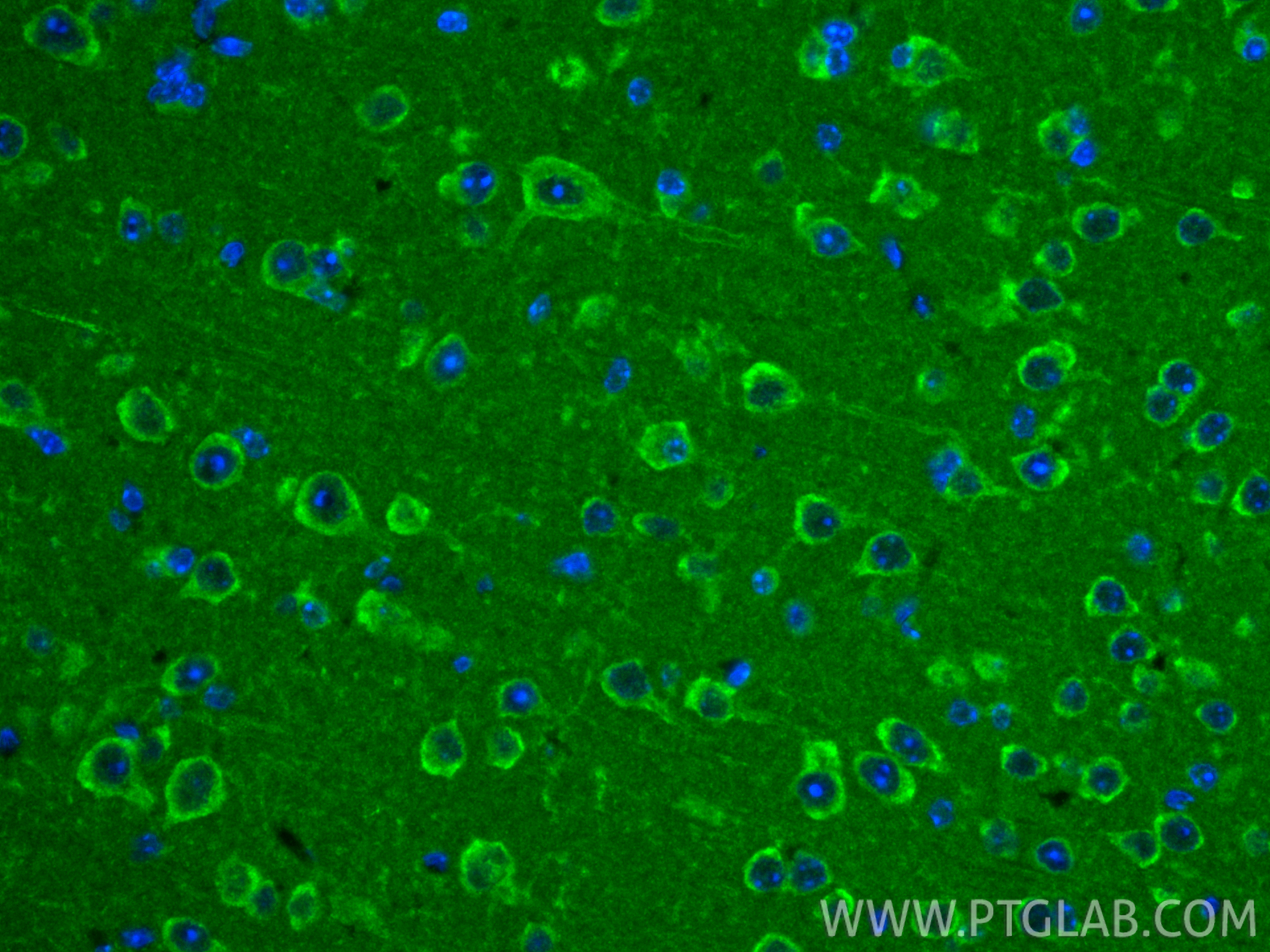 IF Staining of mouse brain using 19891-1-AP IF Staining of mouse brain using 19891-1-AP