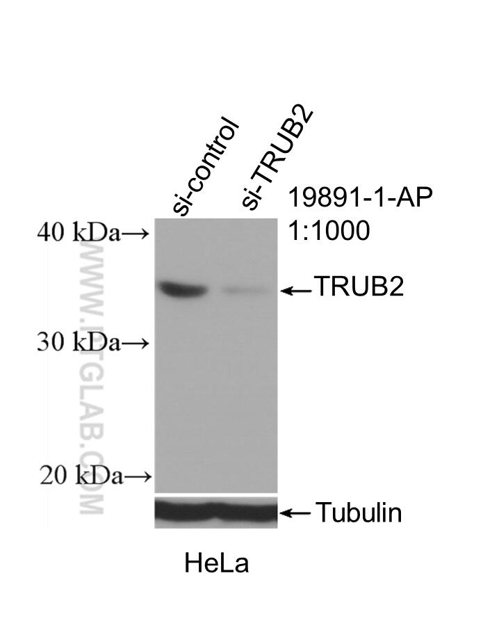 WB analysis of HeLa using 19891-1-AP