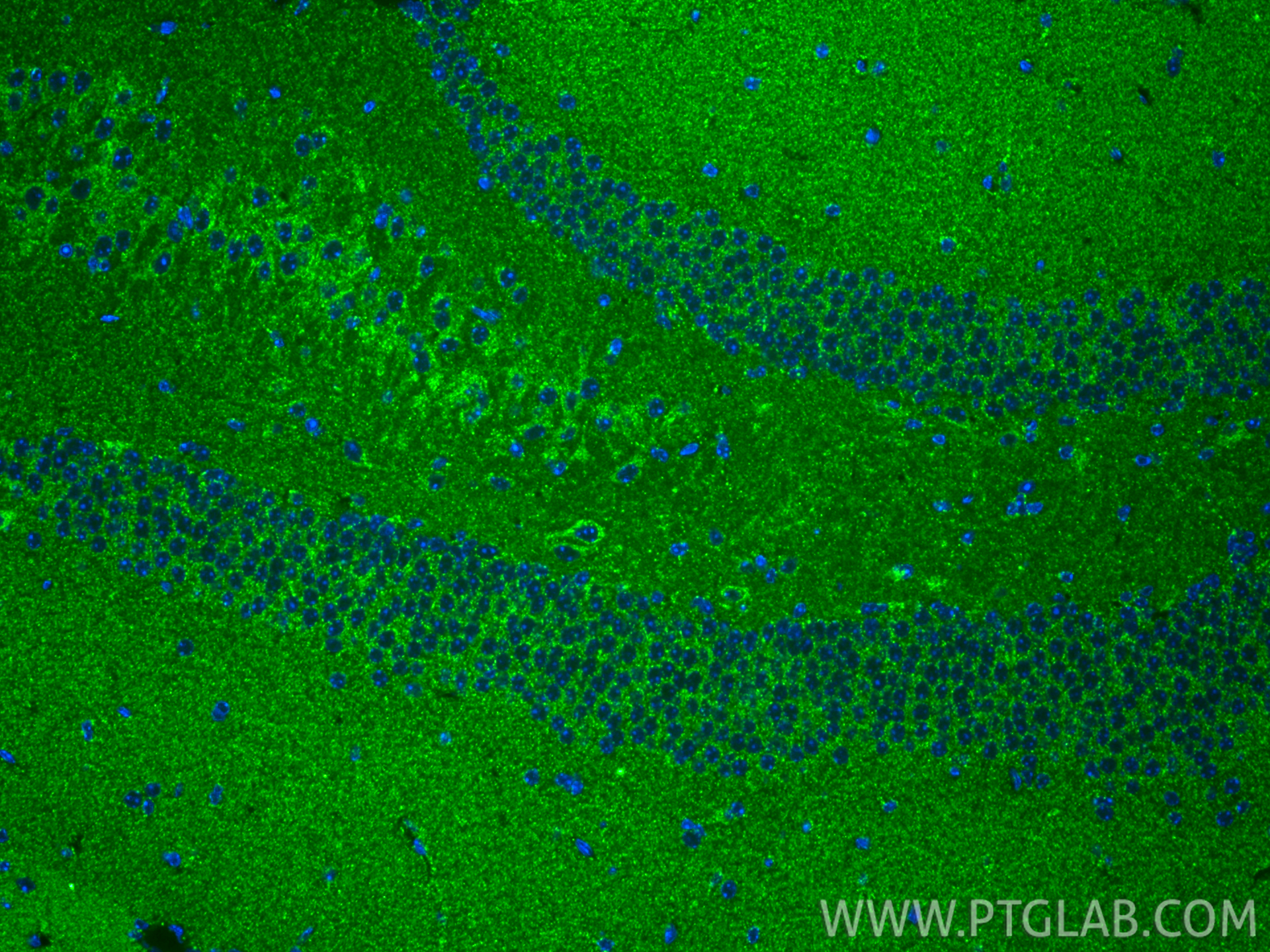 IF Staining of mouse brain using 85212-2-RR IF Staining of mouse brain using 85212-2-RR