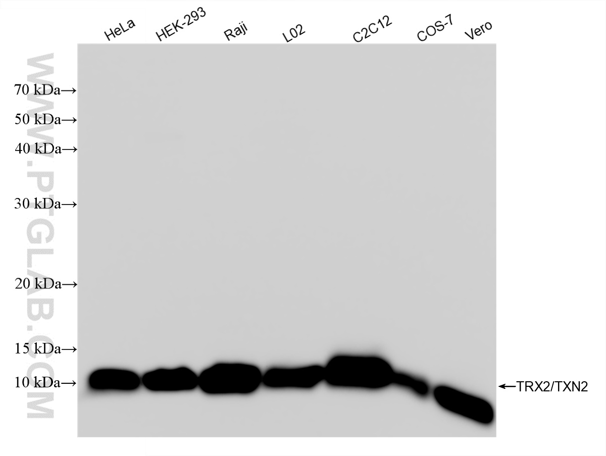 WB analysis using 85212-2-RR (same clone as 85212-2-PBS)
