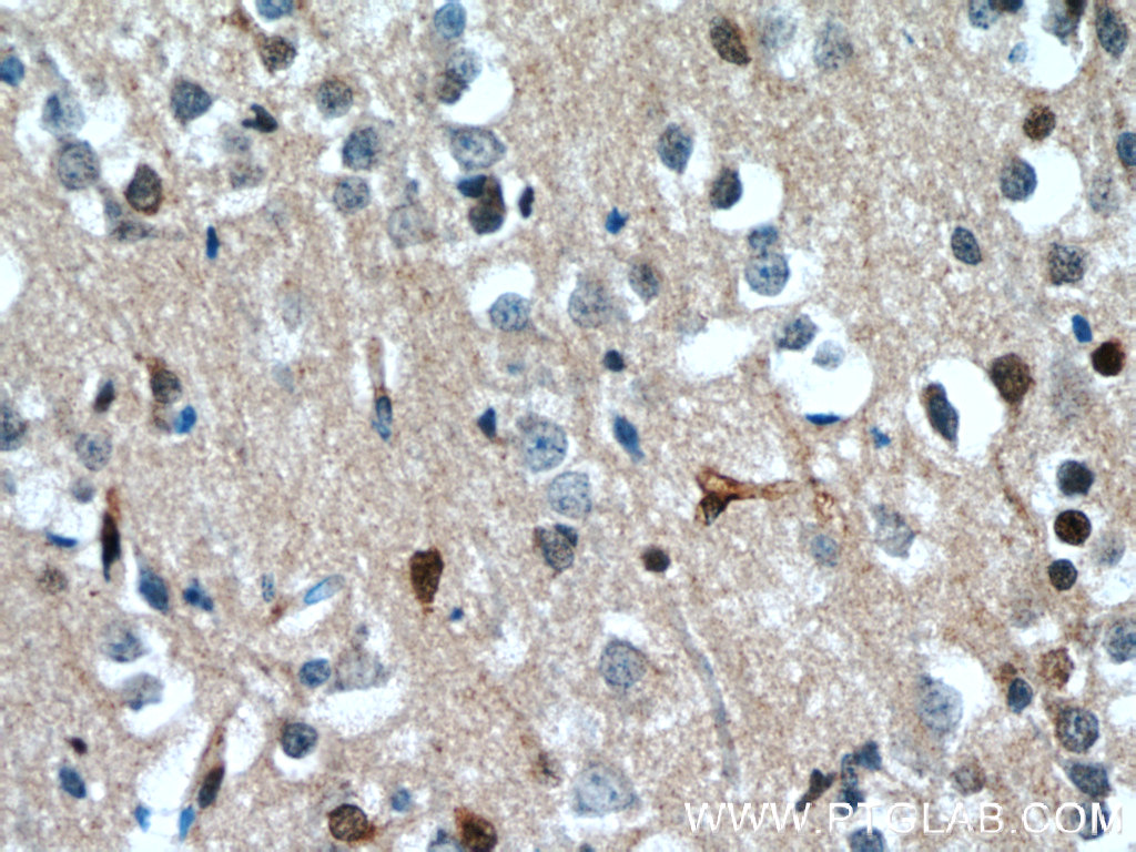 IHC staining of human brain using 10214-1-Ig