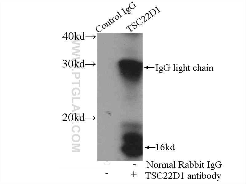 IP experiment of rat brain using 10214-1-Ig