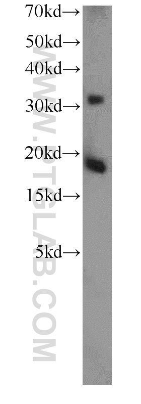 TSC22D1 Polyclonal antibody