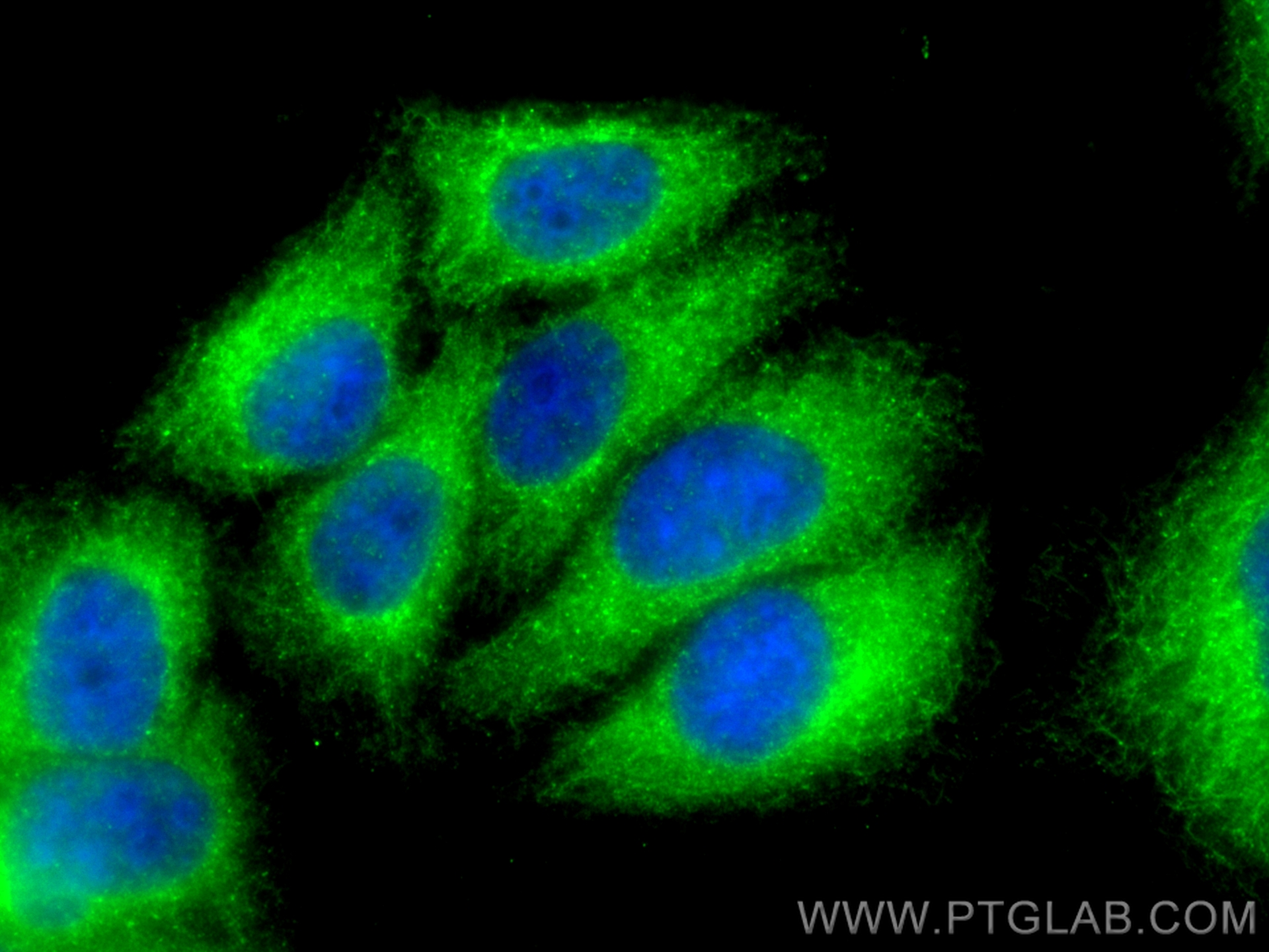 IF Staining of HepG2 using 25418-1-AP
