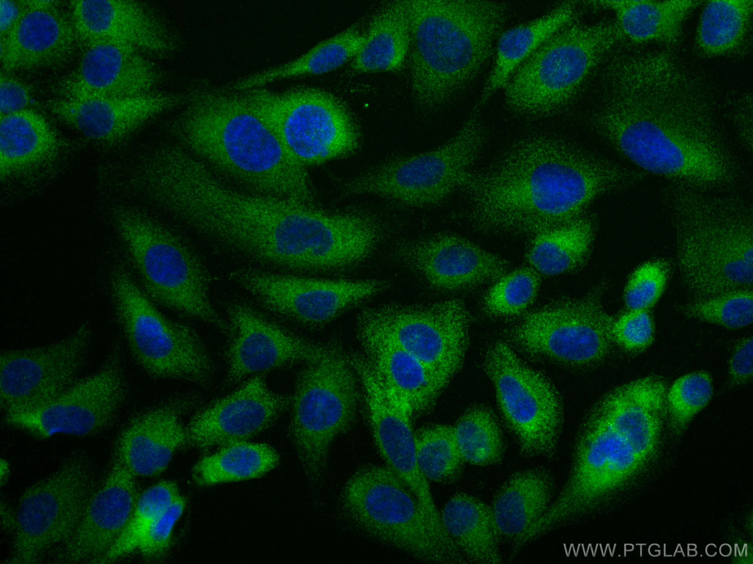 IF Staining of U2OS using 12352-1-AP (same clone as 12352-1-PBS)
