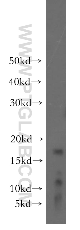 WB analysis of mouse brain using 12352-1-AP