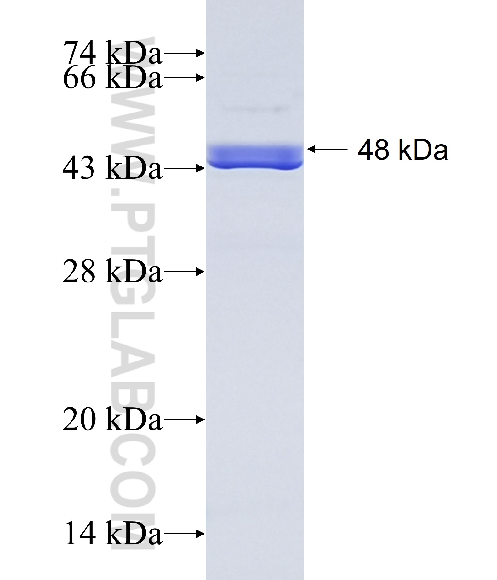 TSEN15 fusion protein Ag22156 SDS-PAGE