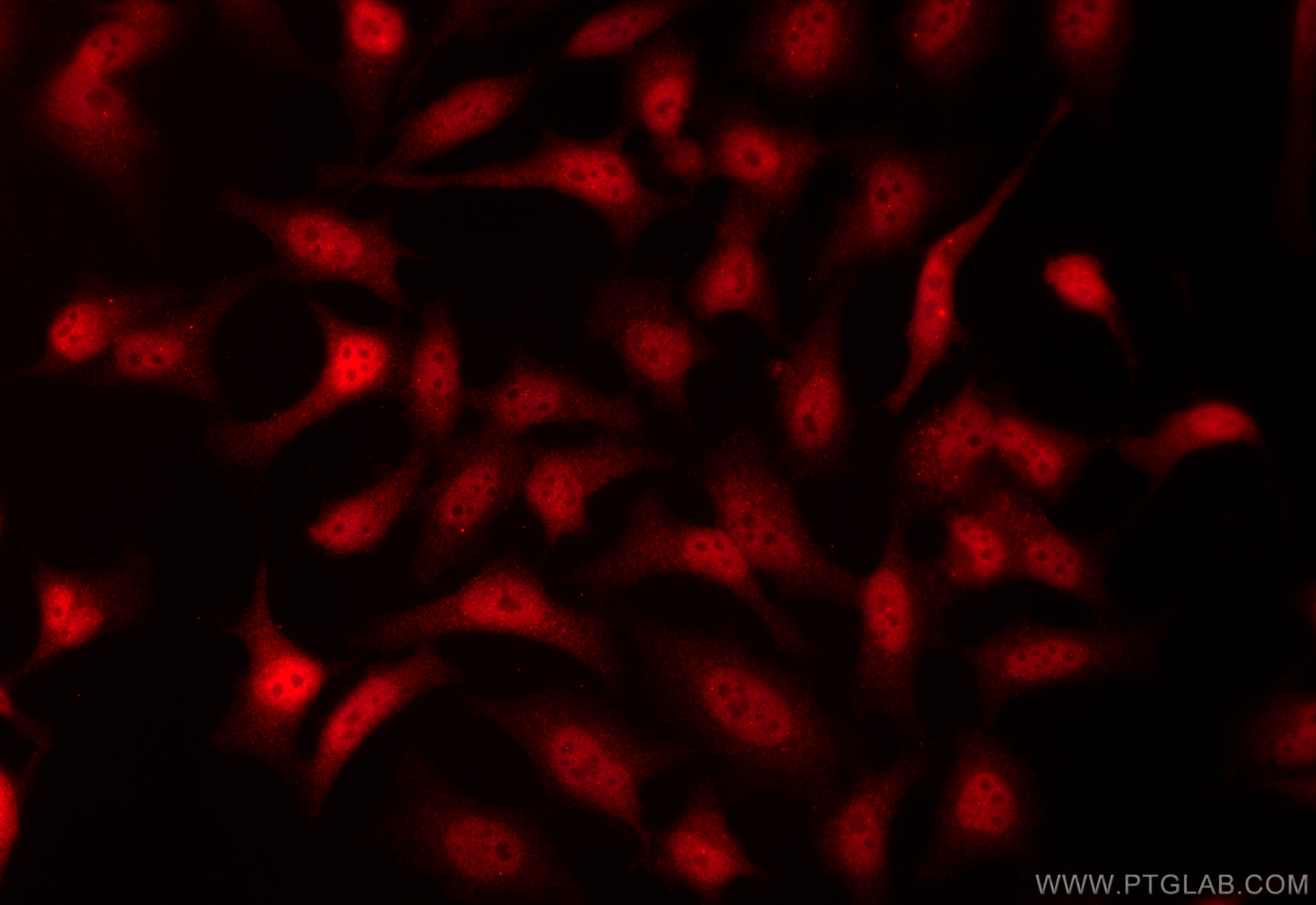 IF Staining of HeLa using 13103-2-AP