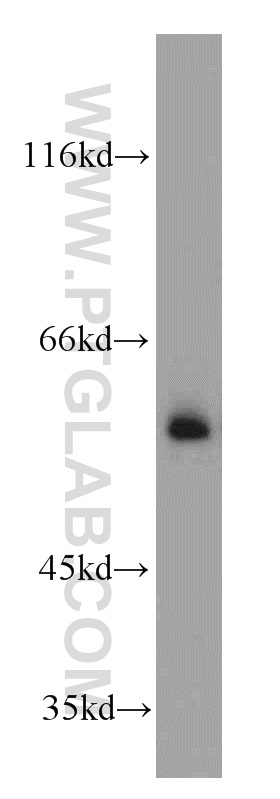 WB analysis of mouse colon using 13103-2-AP