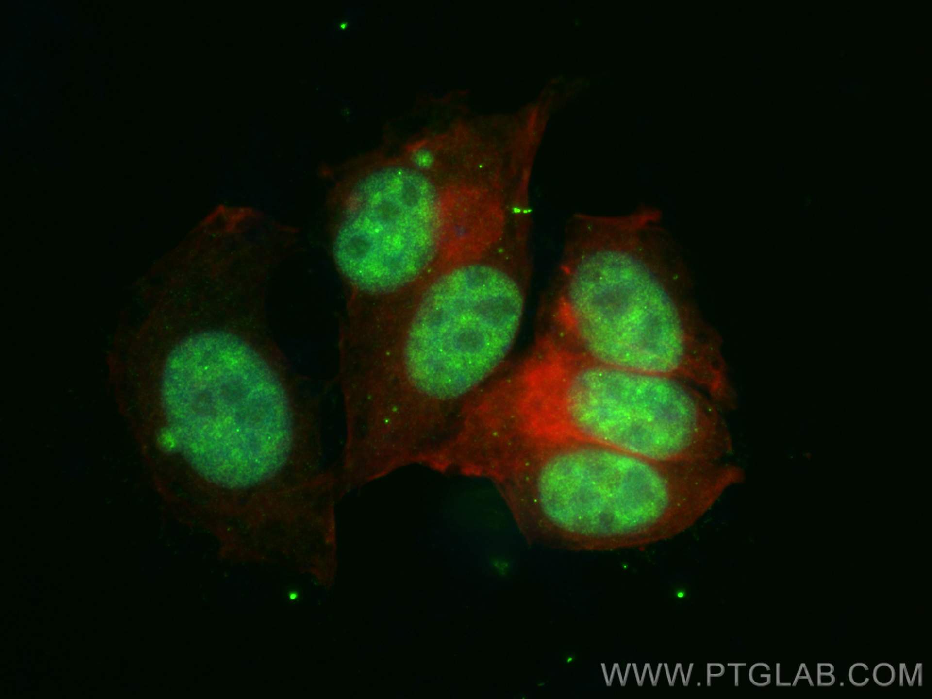 IF Staining of MCF-7 using 31212-1-AP