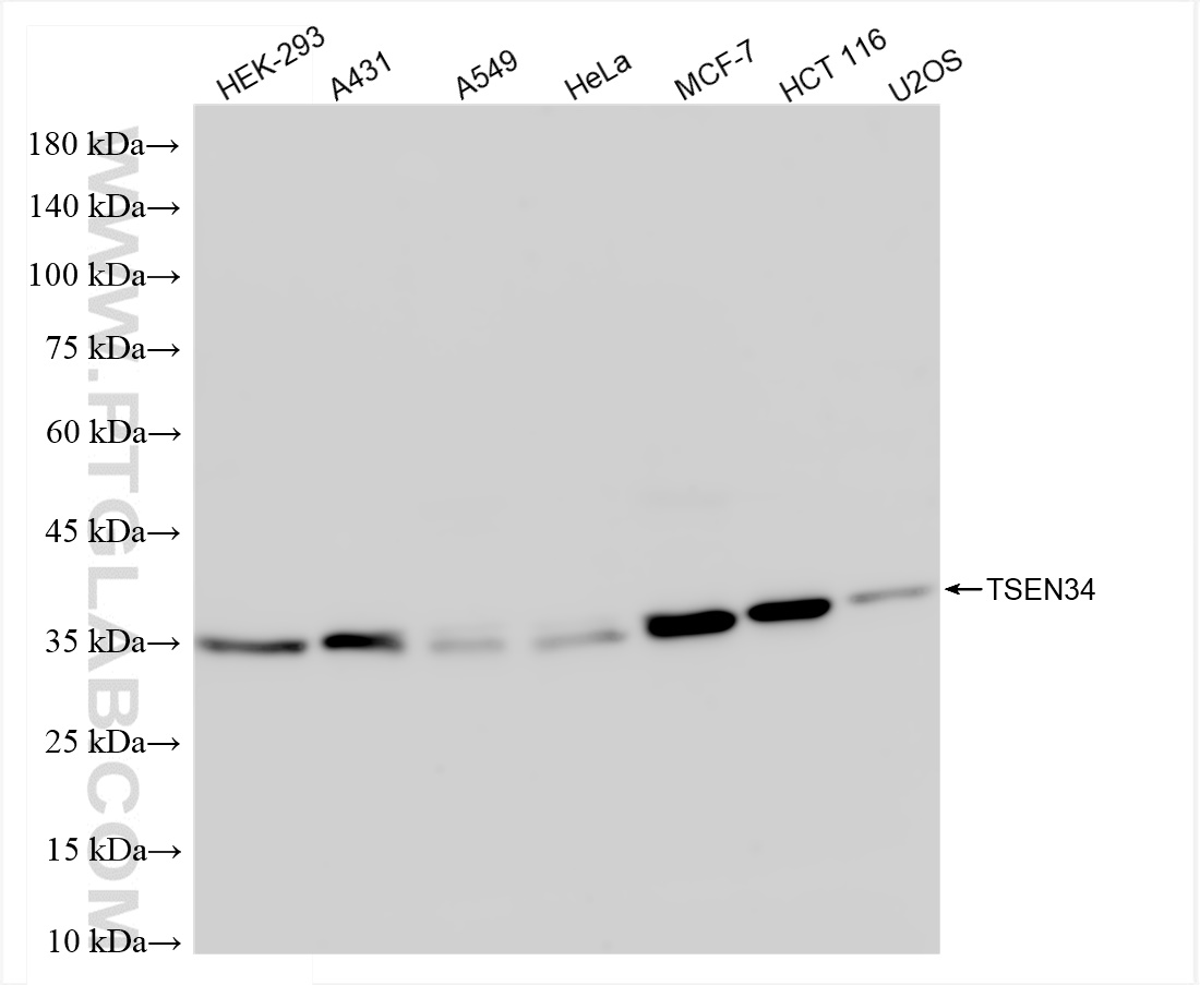 WB analysis using 84102-5-RR (same clone as 84102-5-PBS)