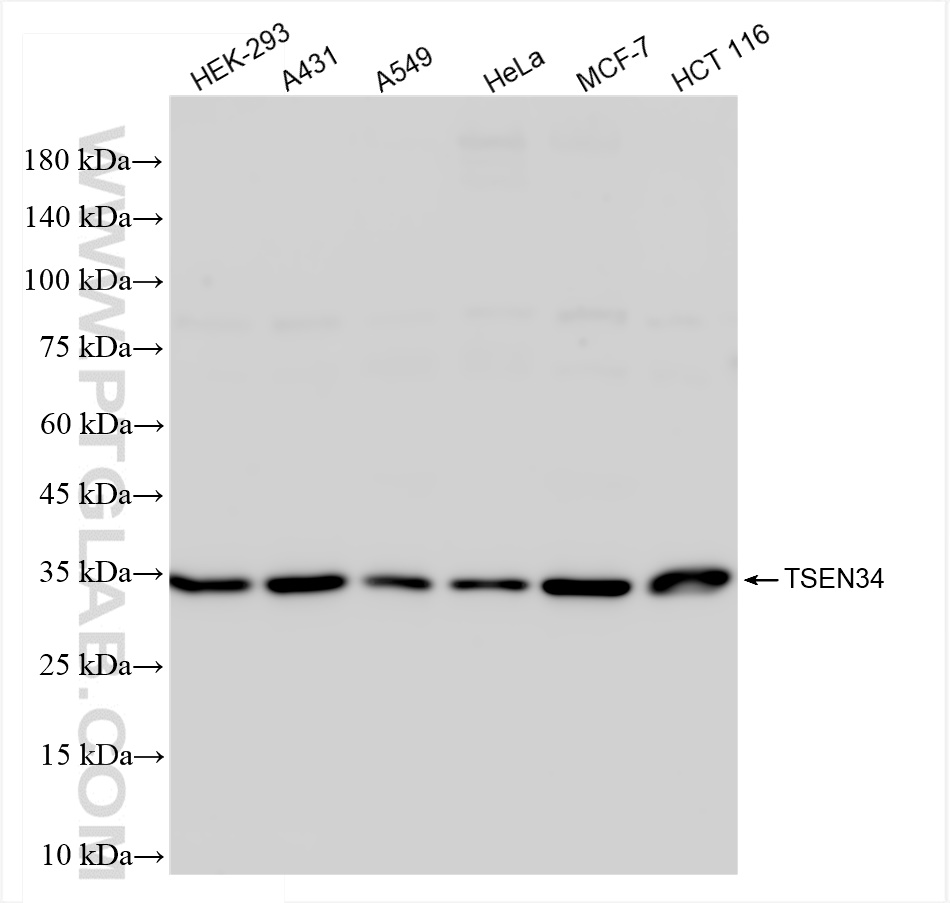 WB analysis using 84102-6-RR (same clone as 84102-6-PBS)