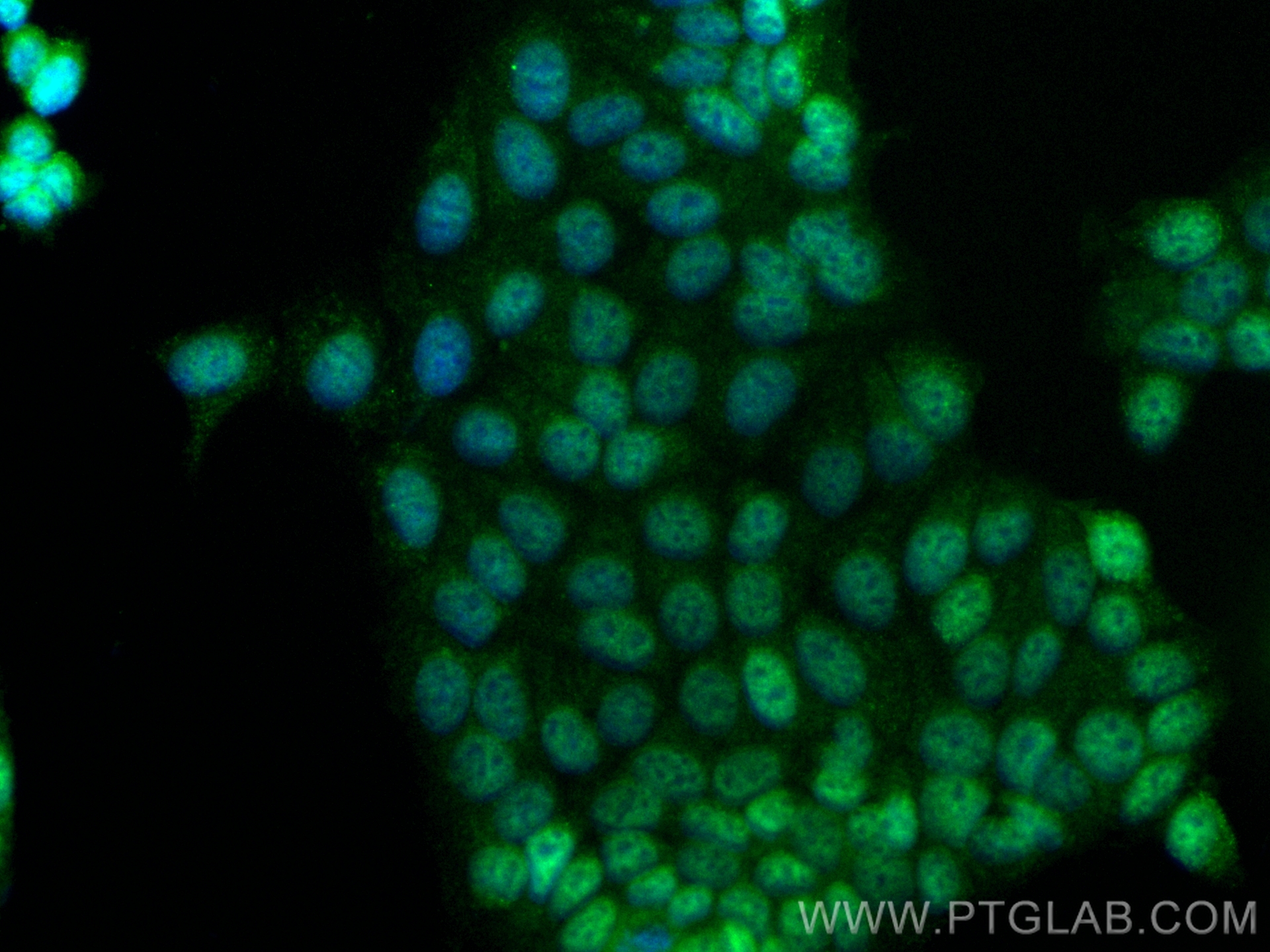 IF Staining of MCF-7 using CL488-84102-5