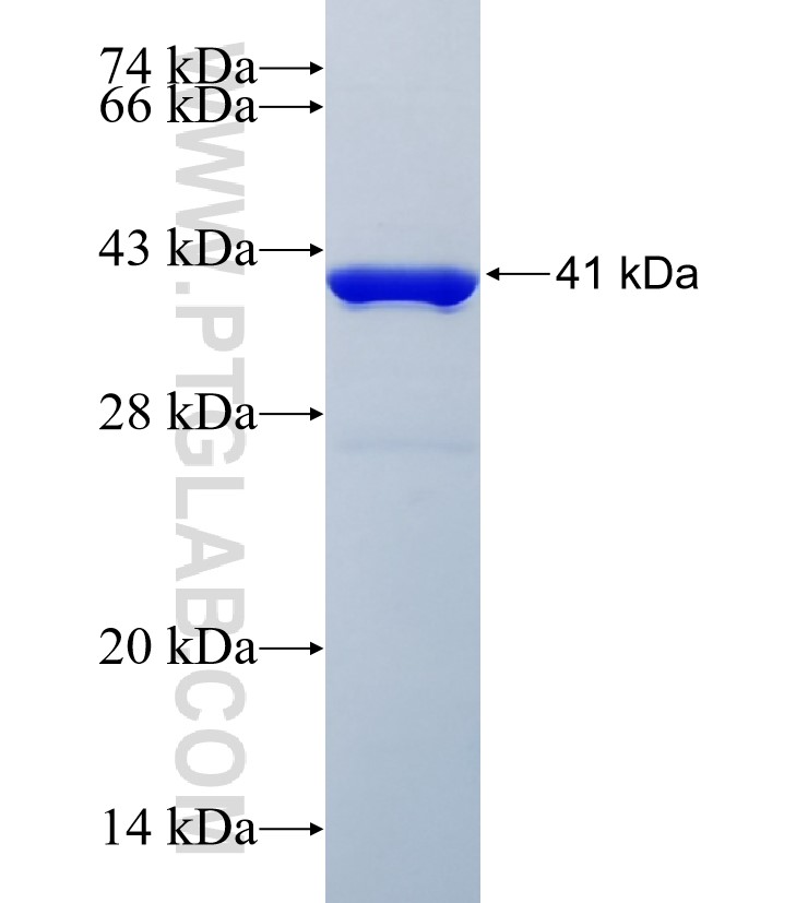 TSEN34 fusion protein Ag35120 SDS-PAGE