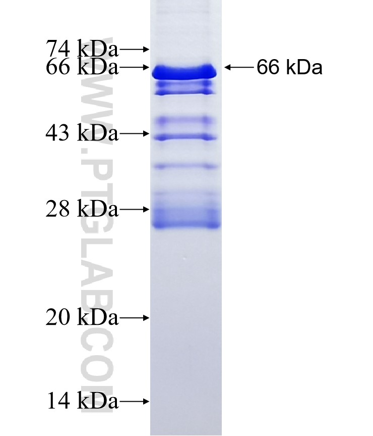 TSEN34 fusion protein Ag10175 SDS-PAGE TSEN34 fusion protein Ag10175 SDS-PAGE