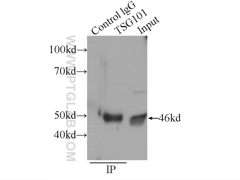 IP experiment of HeLa using 14497-1-AP