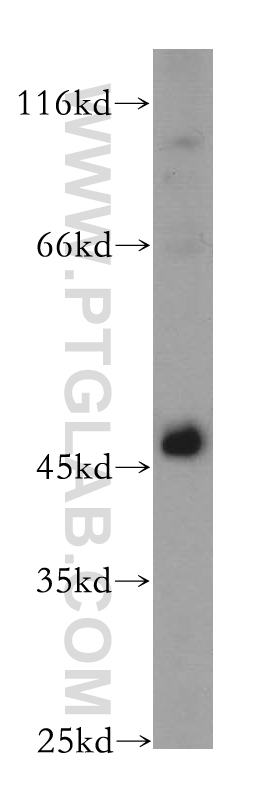 TSG101 Polyclonal antibody