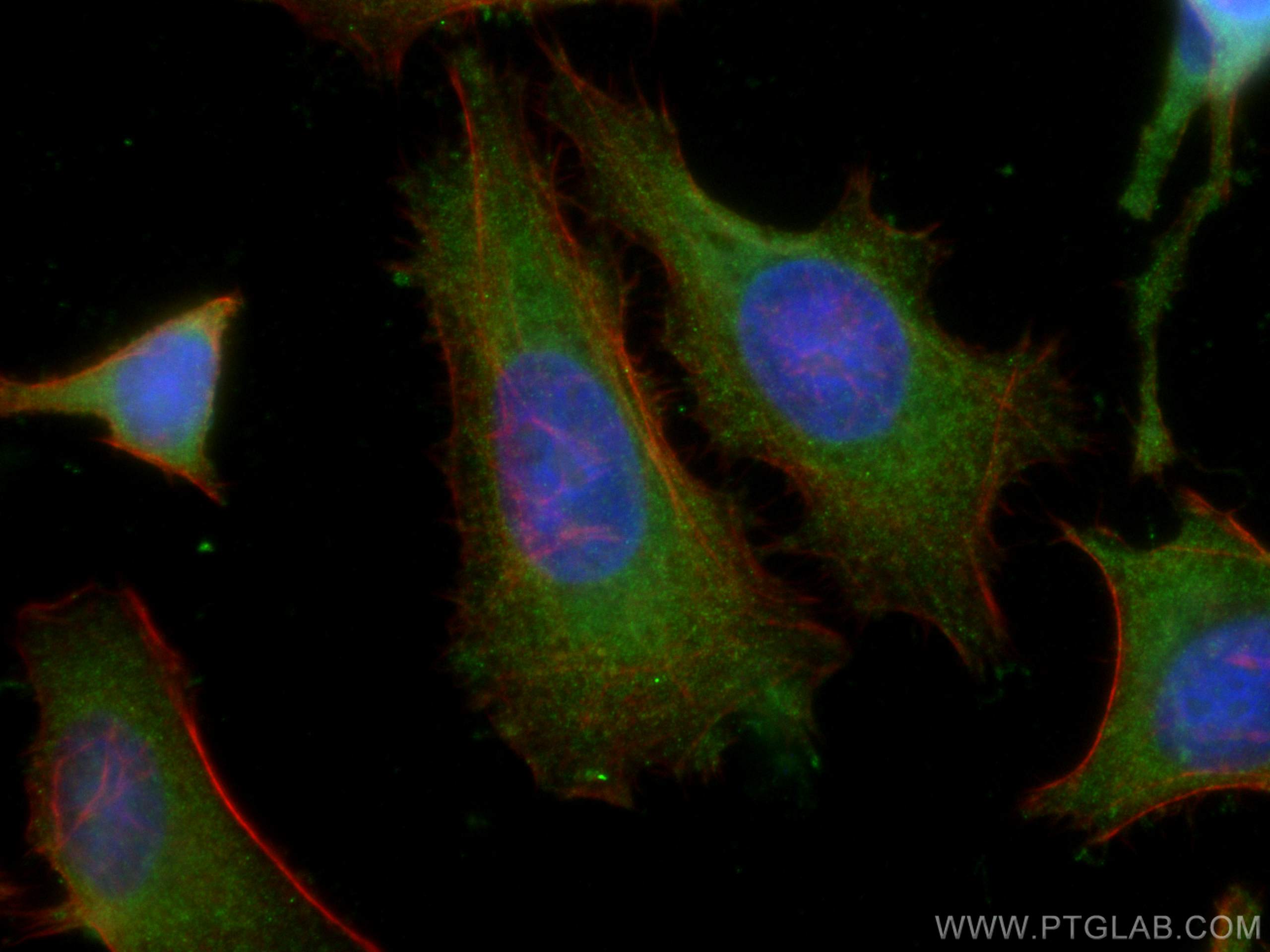 IF Staining of HeLa using 67381-1-Ig (same clone as 67381-1-PBS)