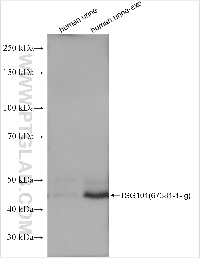 WB analysis of human urine exosomes using 67381-1-Ig (same clone as 67381-1-PBS)