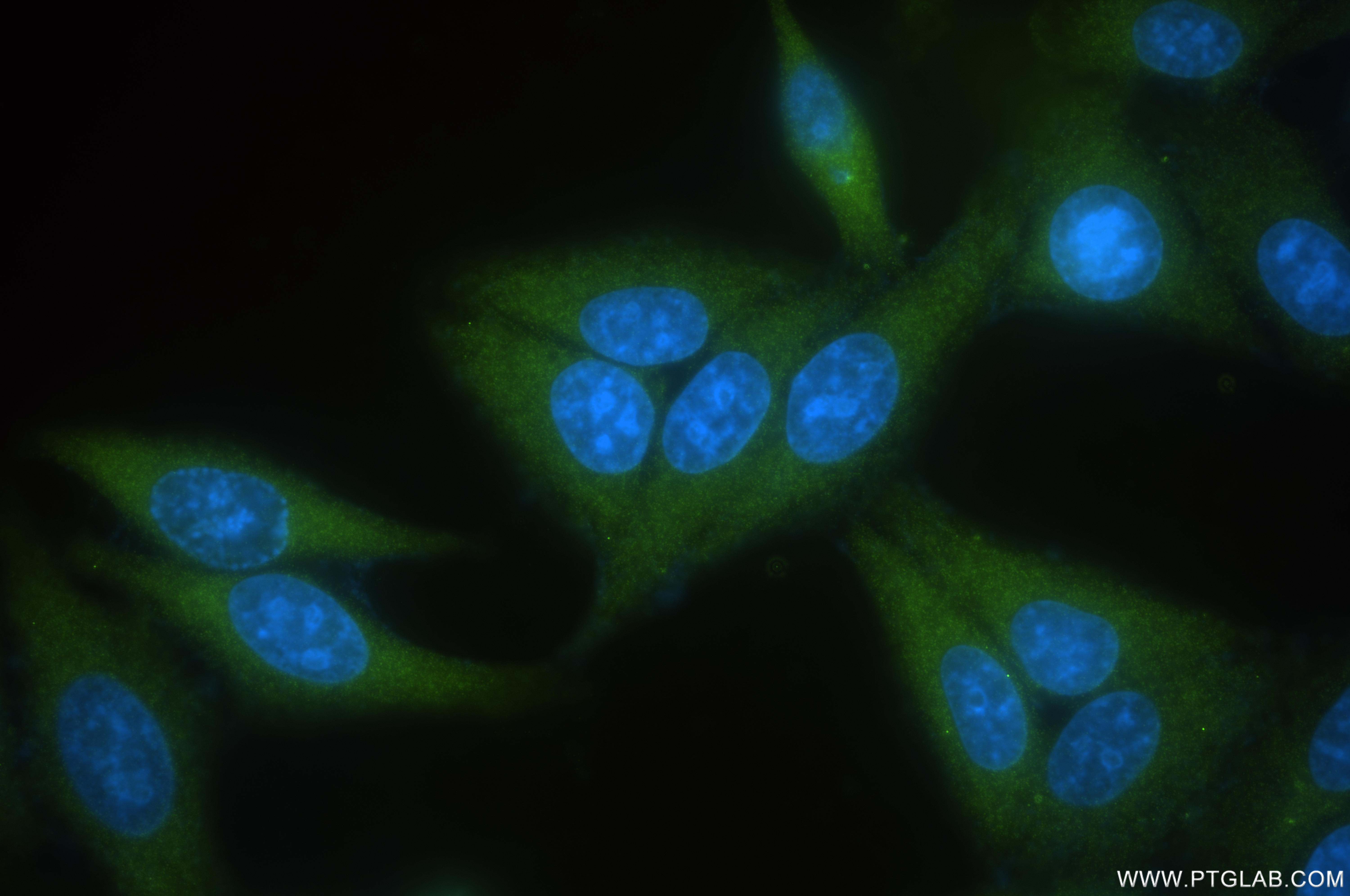 IF Staining of HeLa using 84334-4-RR (same clone as 84334-4-PBS)