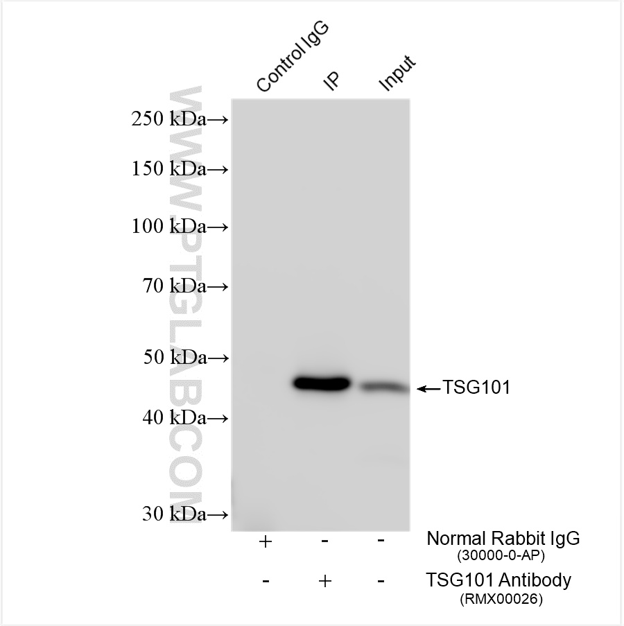 IP experiment of HeLa using RMX00026