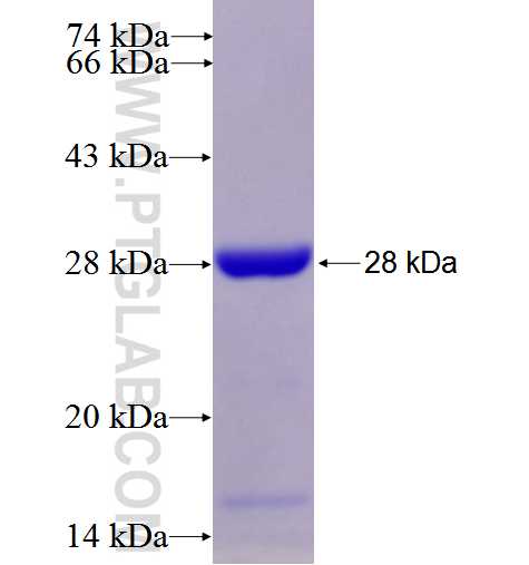 TSG101 fusion protein Ag28569 SDS-PAGE