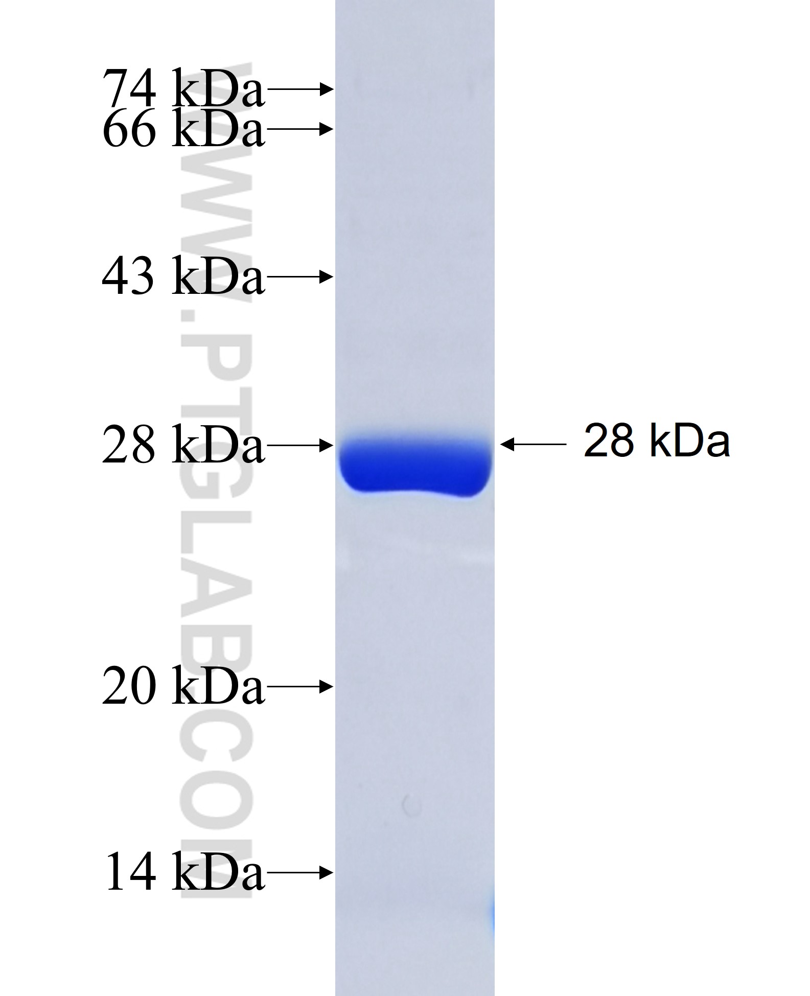 TSG101 fusion protein Ag28569 SDS-PAGE