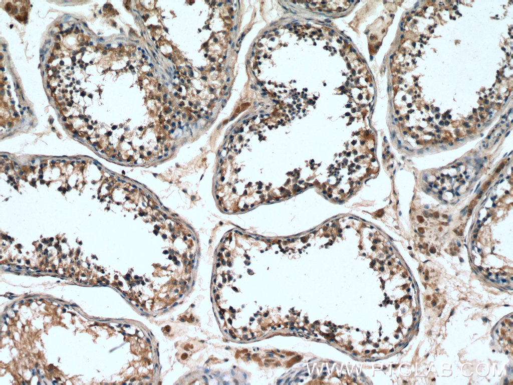 IHC staining of human testis using 12593-1-AP