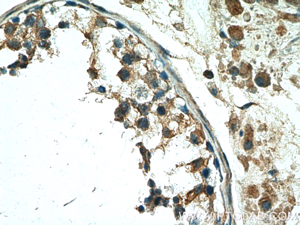 IHC staining of human testis using 12593-1-AP