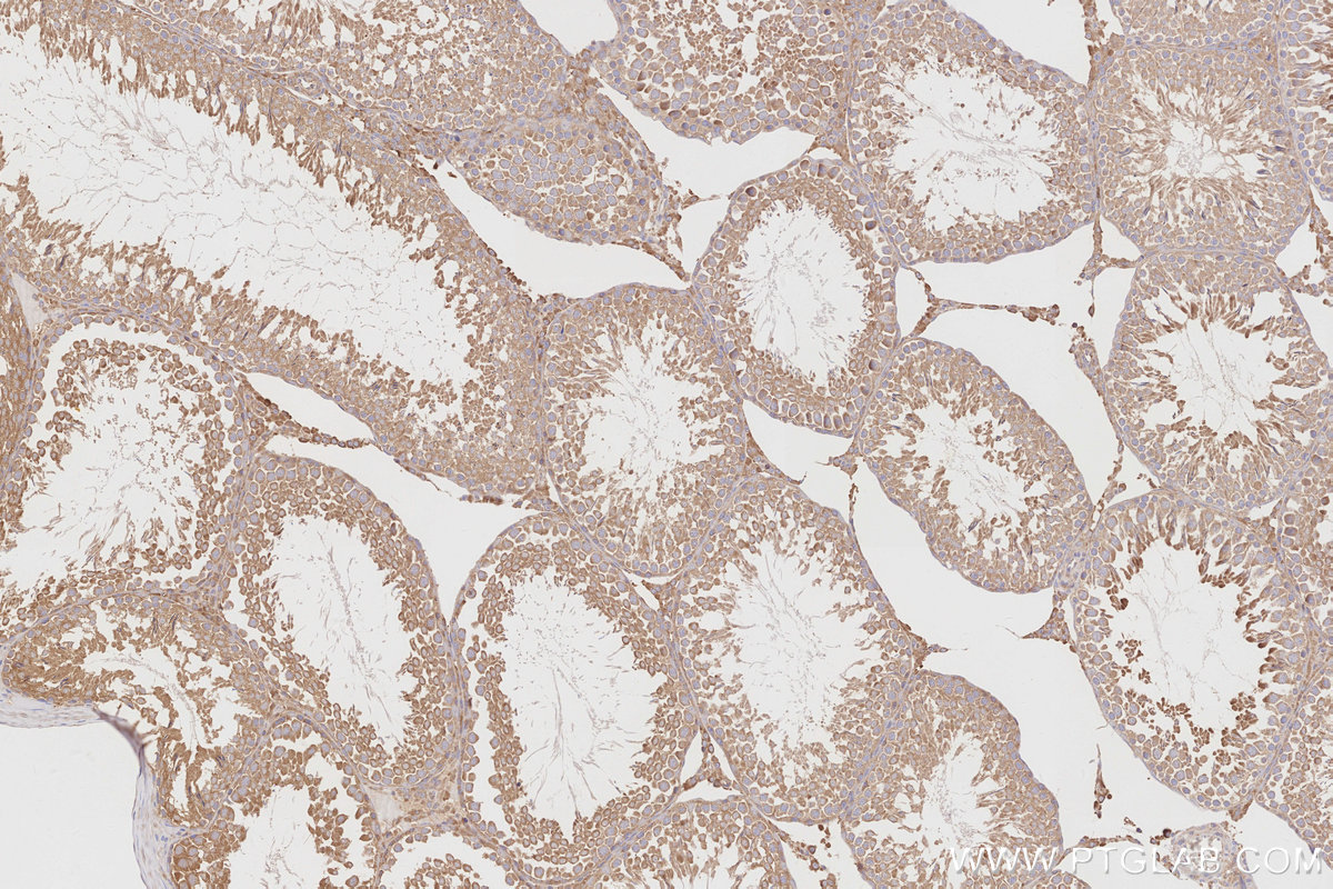 IHC staining of rat testis using 17566-1-AP