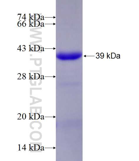 TSGA14 fusion protein Ag11861 SDS-PAGE TSGA14 fusion protein Ag11861 SDS-PAGE
