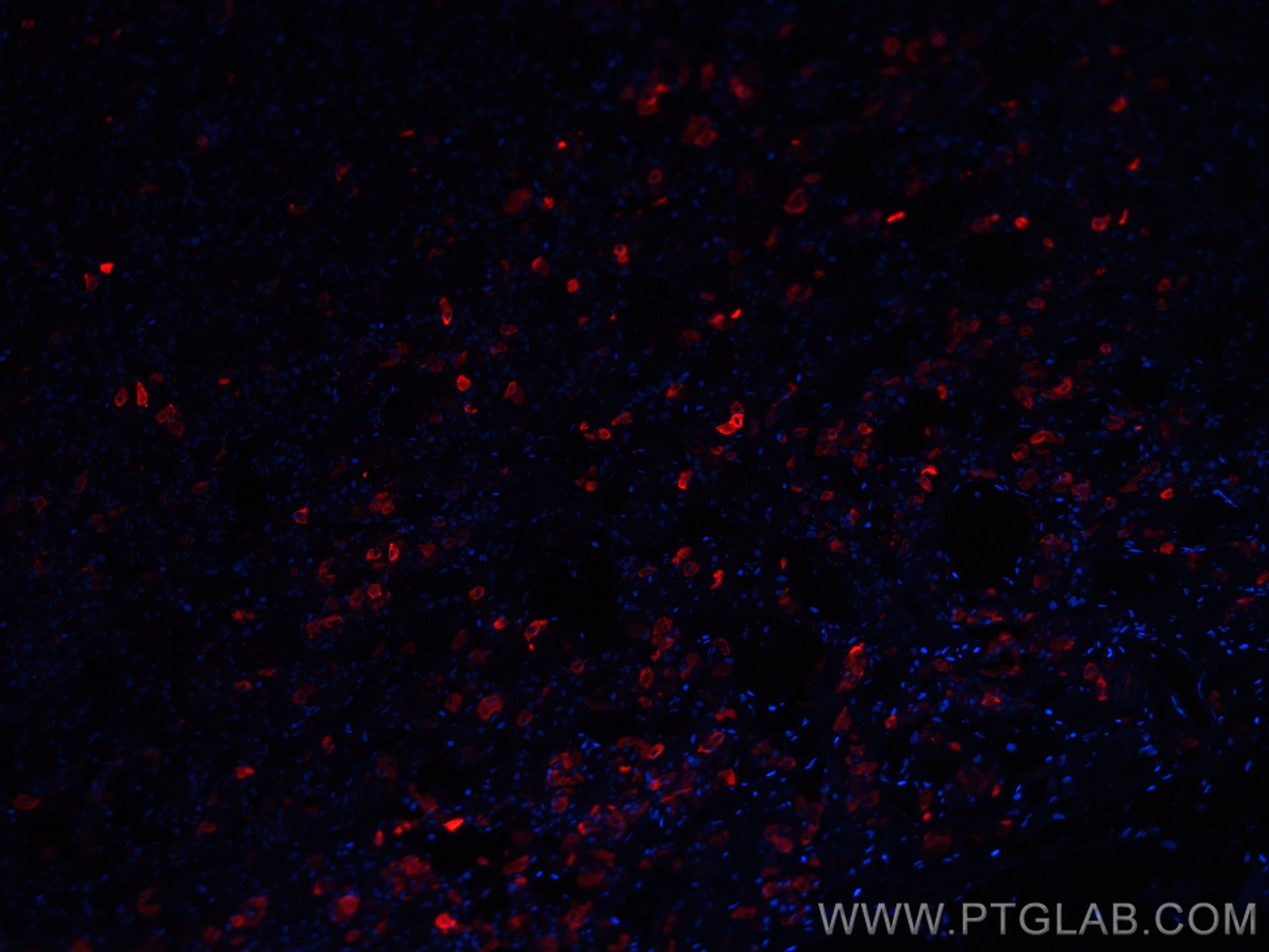 IF Staining of human pituitary using CL594-66750