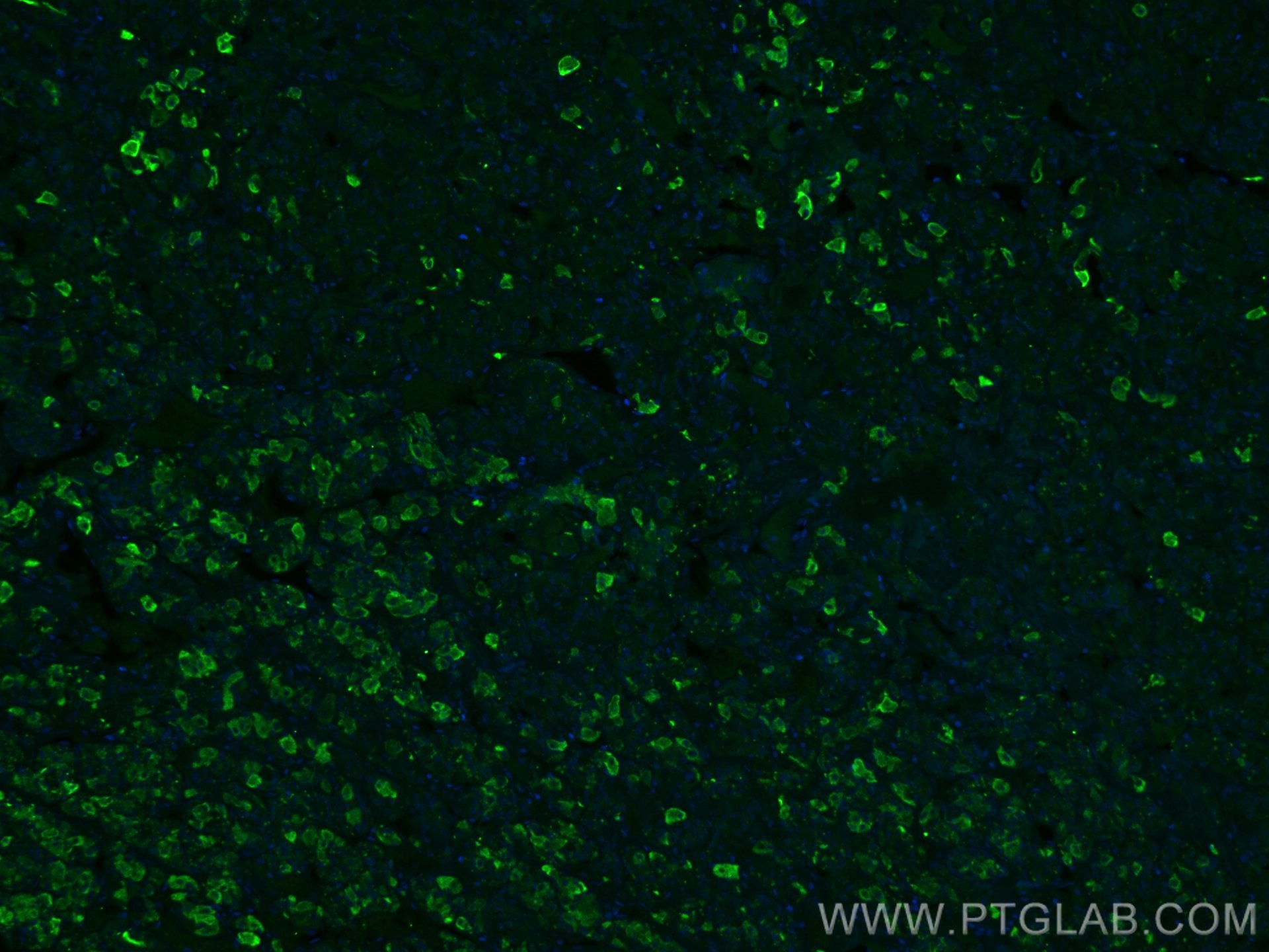 IF Staining of human pituitary using 66750-1-Ig (same clone as 66750-1-PBS)