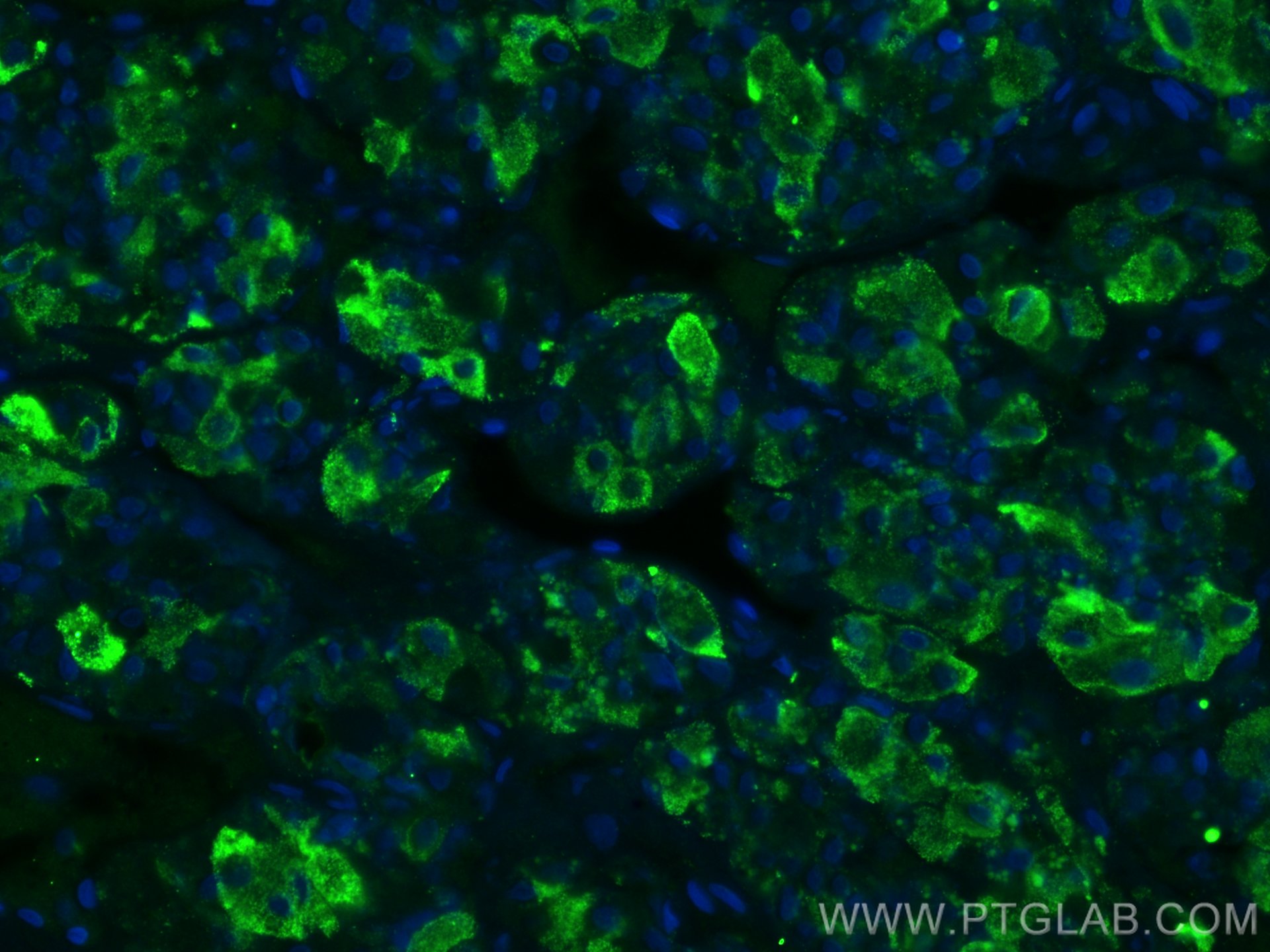 IF Staining of human pituitary using 66750-1-Ig (same clone as 66750-1-PBS)