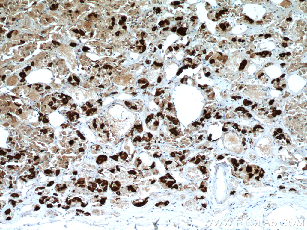 IHC staining of human pituitary using 66750-1-Ig (same clone as 66750-1-PBS)