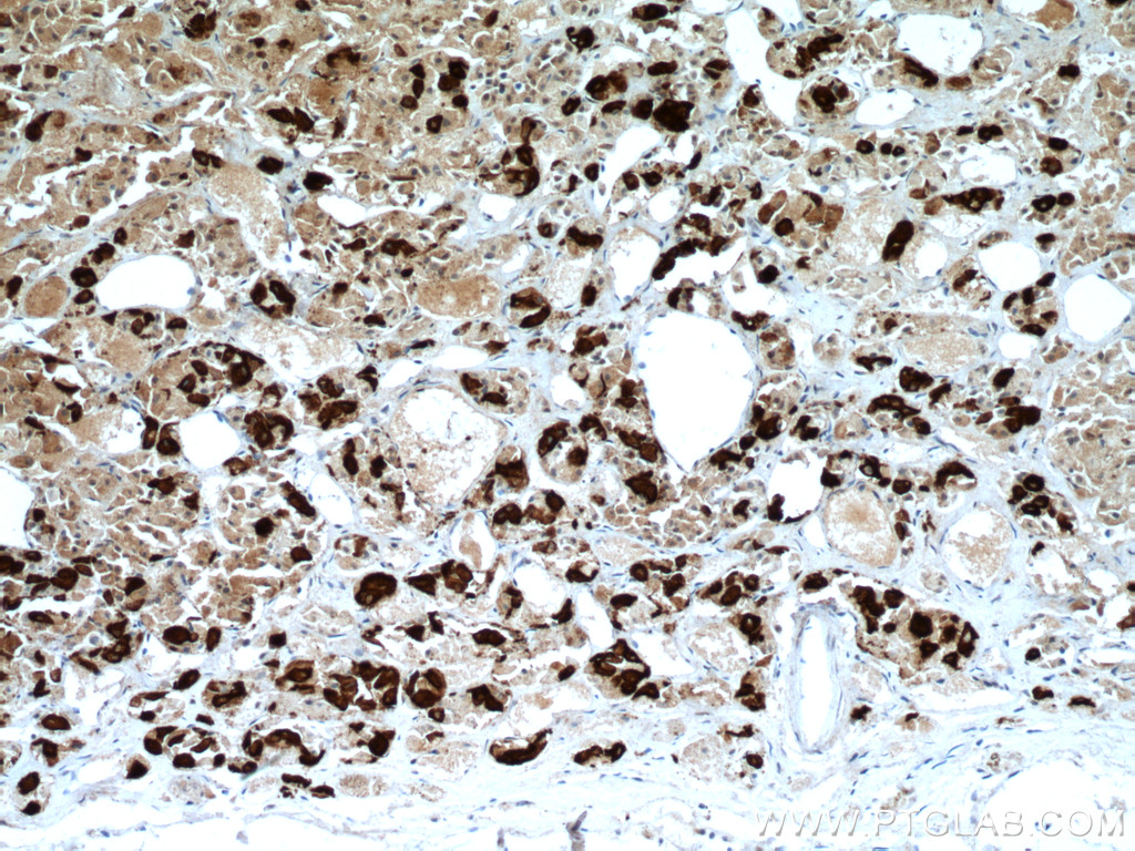 IHC staining of human pituitary using 66750-1-Ig