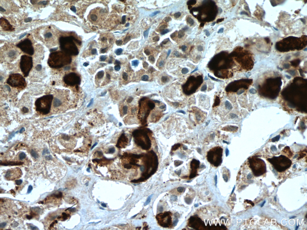 IHC staining of human pituitary using 66750-1-Ig (same clone as 66750-1-PBS)