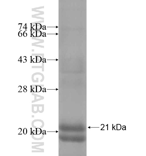 TSH-beta fusion protein Ag10721 SDS-PAGE TSH-beta fusion protein Ag10721 SDS-PAGE