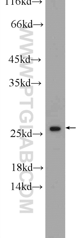 WB analysis of Jurkat using 55426-1-AP