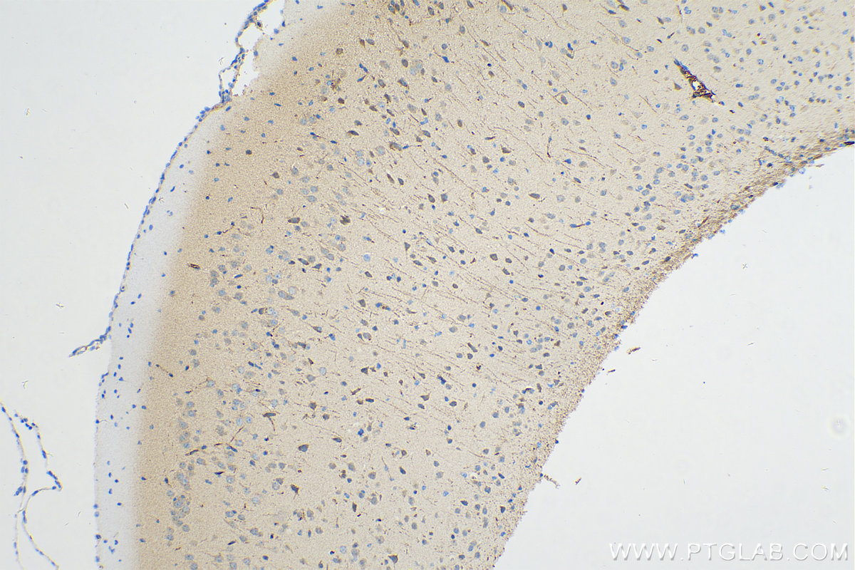 IHC staining of mouse brain using 24084-1-AP
